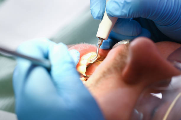 Best Emergency Cosmetic Dentistry (e.g., broken veneers) in Crow Agency, MT